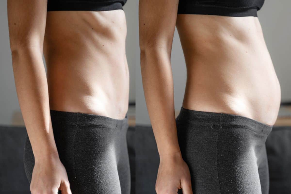 How long does diastasis recti take to improve Bootle?