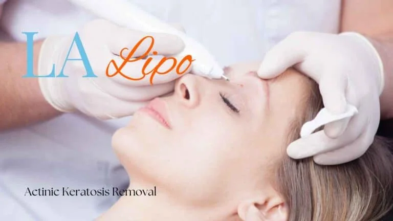 Woman receiving Actinic Keratosis Removal Treatment Bootle