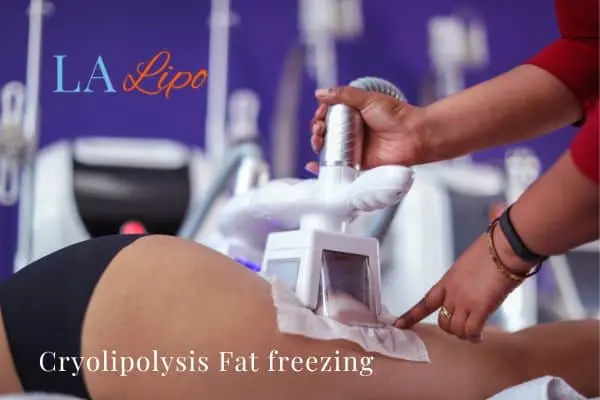 women getting fat freezing Bootle