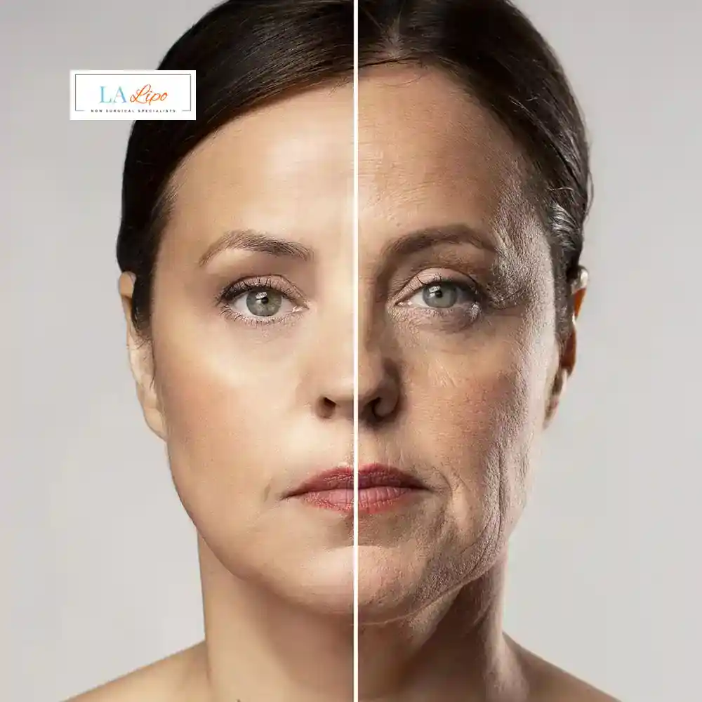 How Can You Tell If Non-Surgical Skin Tightening Is Right for You Bootle?