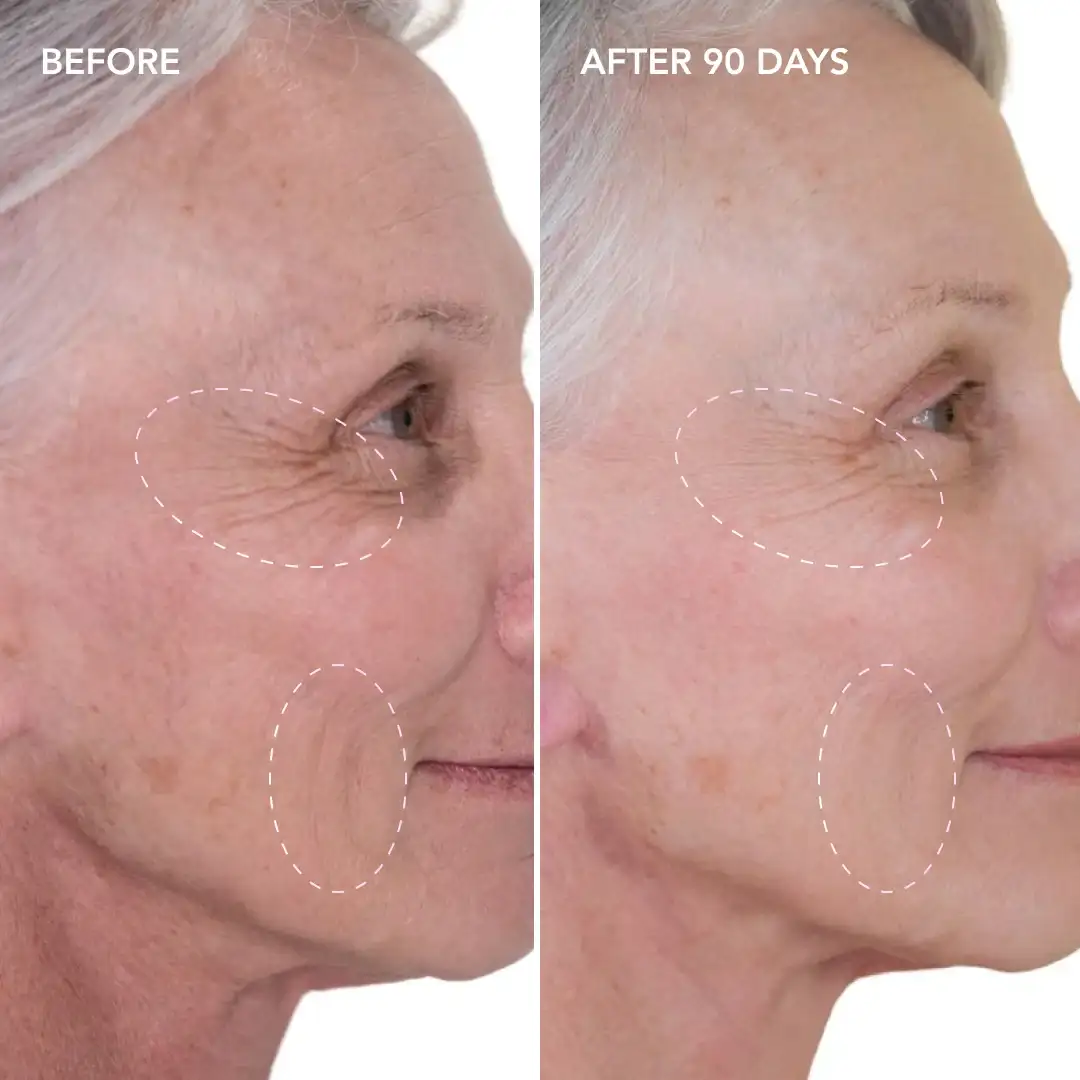 When will you see results Bootle